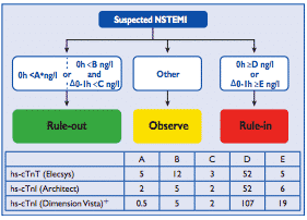 Sindrome Coronarica Acuta: linee guida ESC