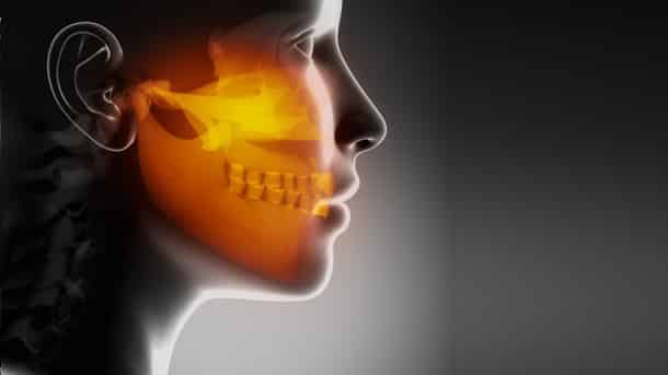 Osteonecrosi da bifosfonati