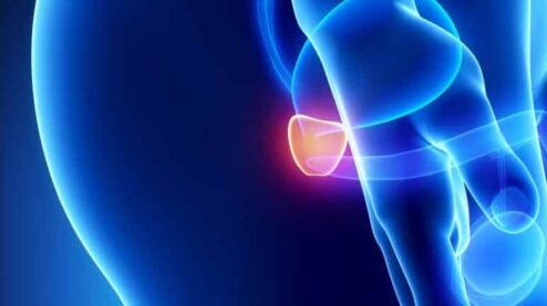 Quando prendere gli integratori per la prostata?