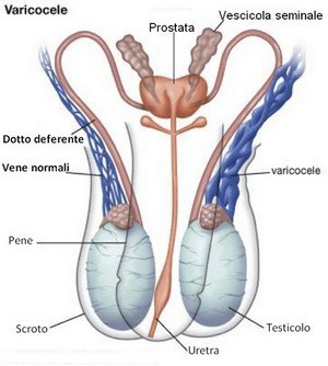 Varicocele: anatomia