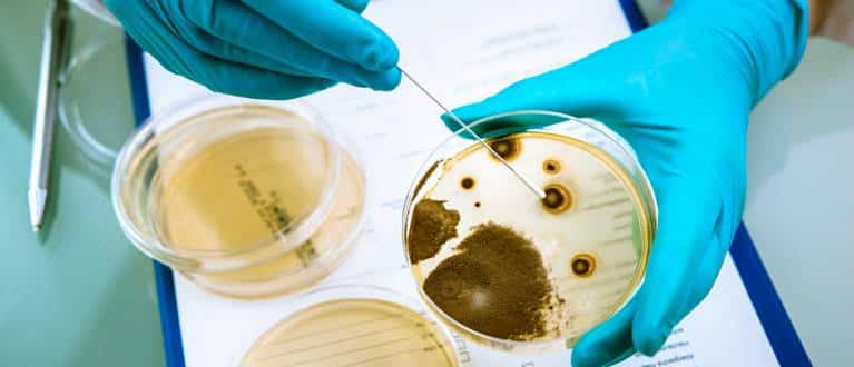 Listeriosi: coltura su agar