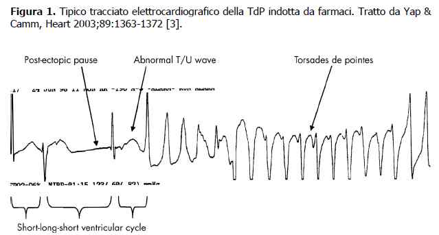 Azitromicina e rischio cardiovascolare: torsione di punta