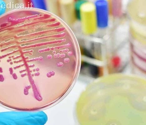 malattie infettive: streptococco, covid, omicron 5, influenza