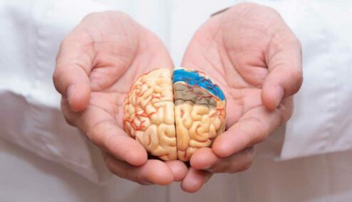 Cosa succede nel cervello di un malato di Alzheimer?