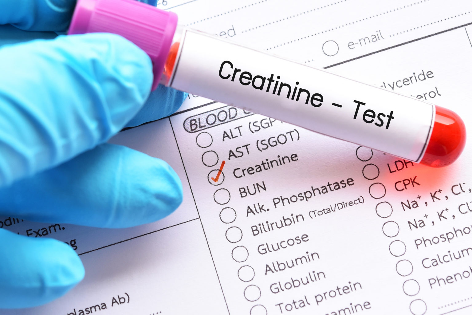 Quali alimenti sono ricchi di creatinina?