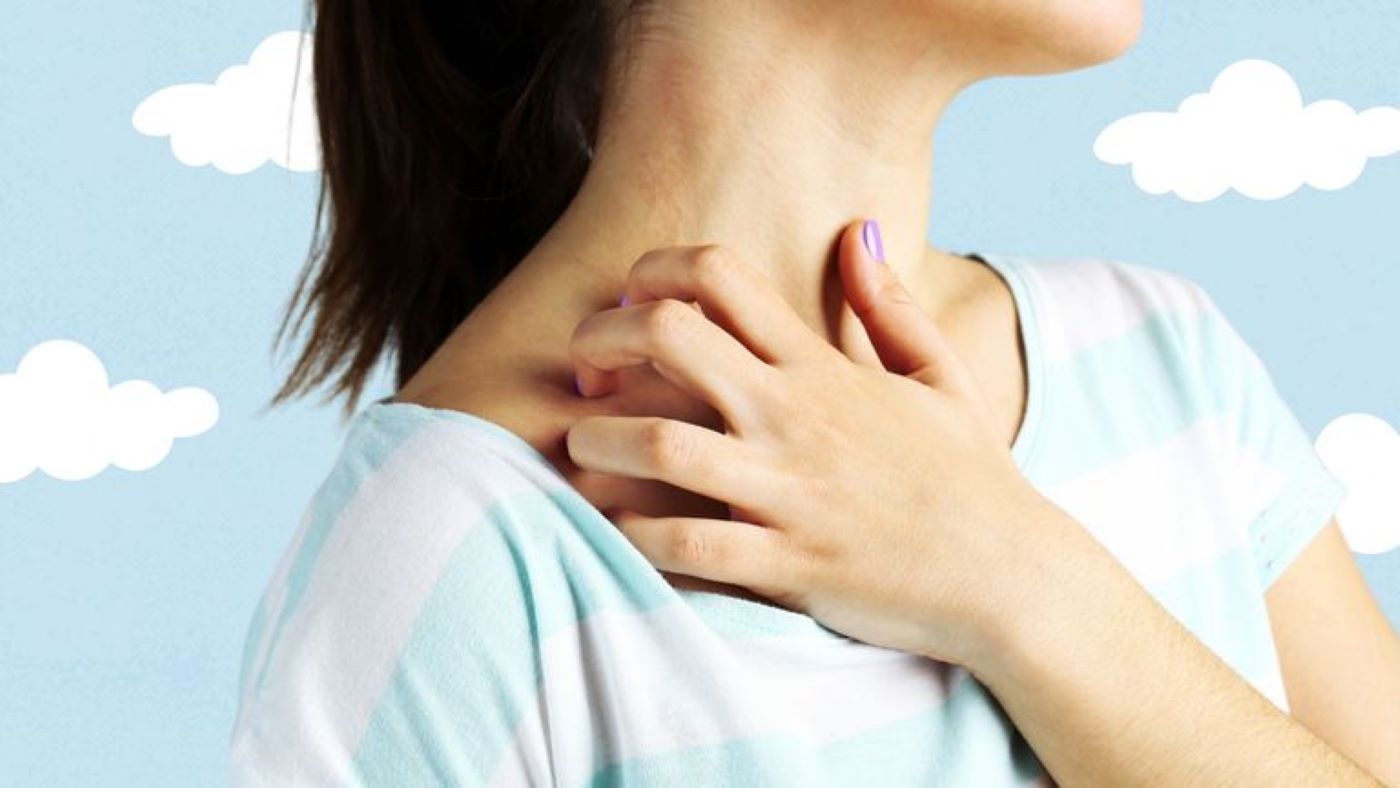 Quanto dura la fase acuta della dermatite atopica?