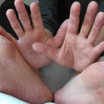 mani-piedi-bocca