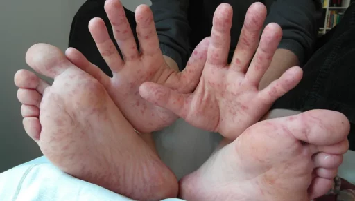mani-piedi-bocca
