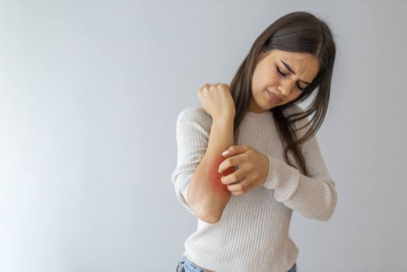 Qual è la crema migliore per l’orticaria?