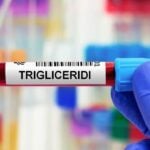 trigliceridi