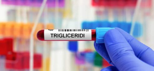 Trigliceridi: cosa sono, a cosa servono, cosa indicano