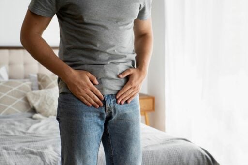 varicocele