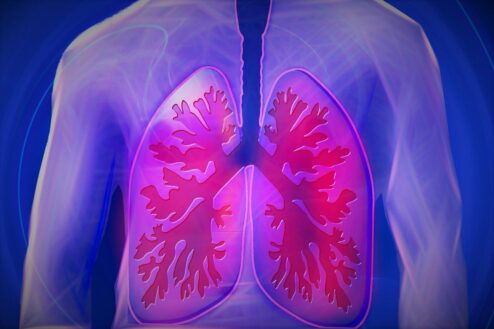 Che differenza c’è tra la polmonite e la broncopolmonite?