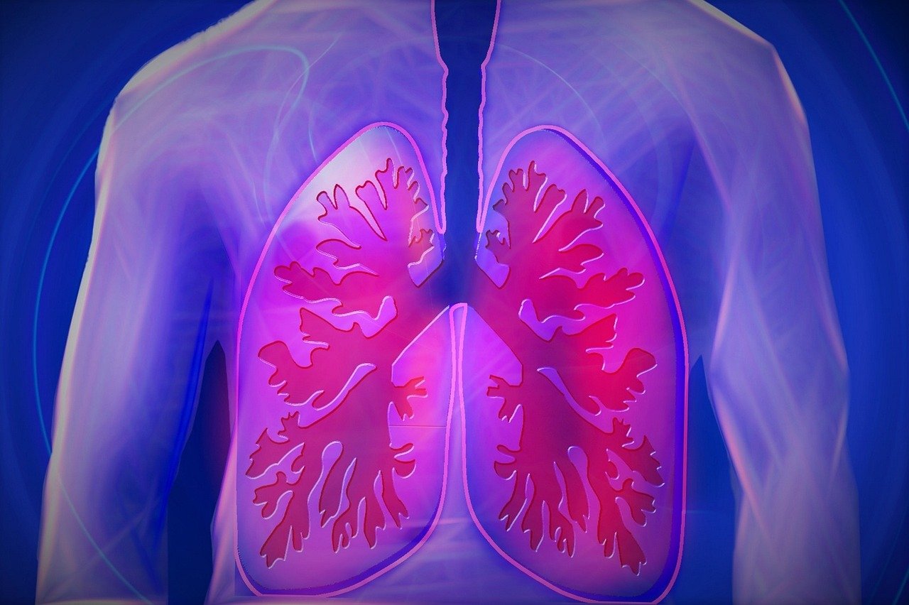 Come si chiama il batterio della polmonite?