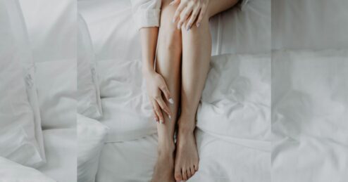 Come eliminare i capillari sulle gambe in modo naturale?