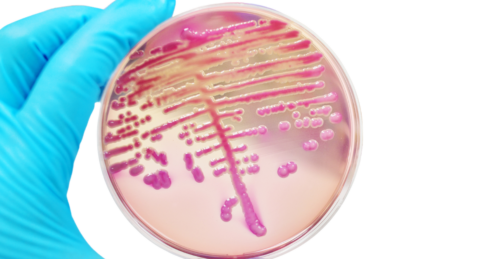 Quanto vive il batterio Escherichia coli?
