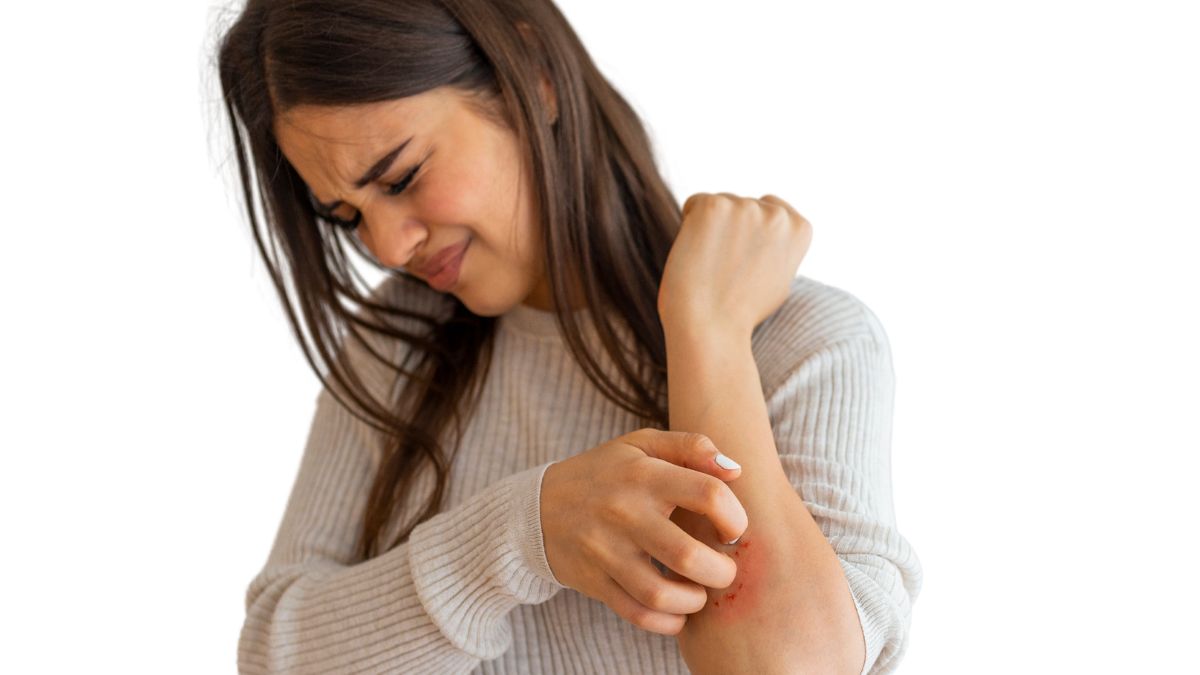 Come si fa a vivere con la psoriasi?