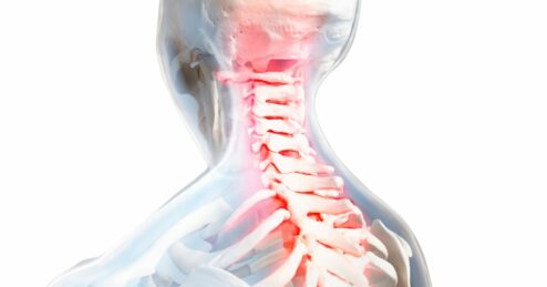 Quale moment va bene per la cervicale?