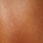 Abbronzatura_ pelle ed efelidi