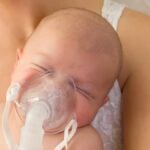 Aerosol_ neonato