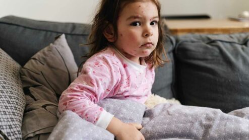 Da quando è obbligatorio il vaccino del morbillo?