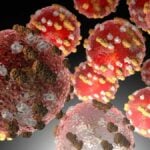 Cellule del virus del morbillo