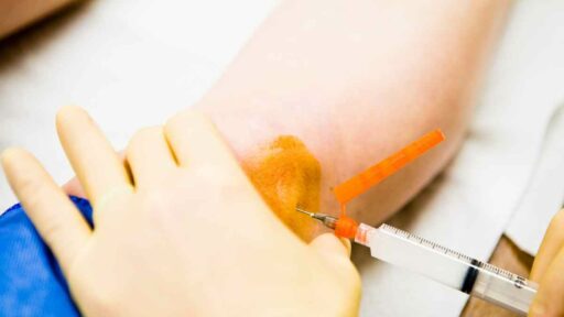 Cortisone - iniezione