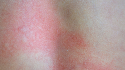 Colestrilblu 15cpr: Scheda Tecnica del Parafarmaco