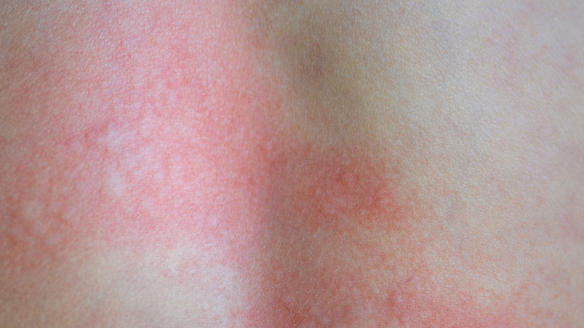 Colestrilblu 15cpr: Scheda Tecnica del Parafarmaco