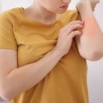 Nickel allergy - girl scratching her arm