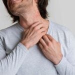 Nickel allergy - man with severe neck irritation