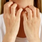 Nickel allergy - woman scratching her neck