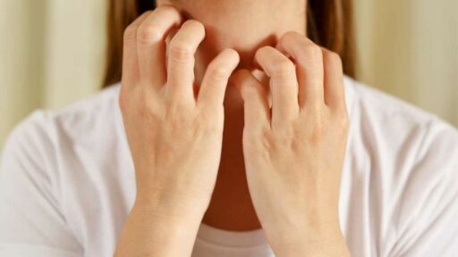 Nickel allergy - woman scratching her neck