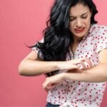 Nickel allergy - woman with severe itching on arm