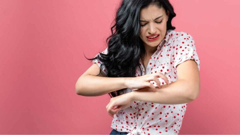 Nickel allergy - woman with severe itching on arm