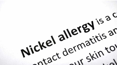 How do you remove nickel from your body?