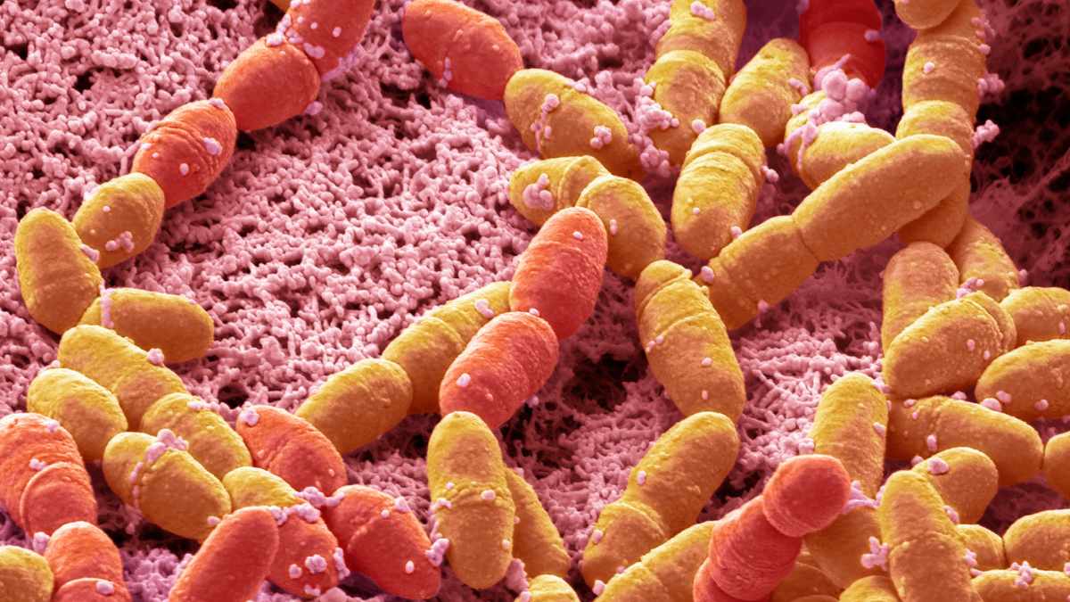 Cosa prendere per lo streptococco?