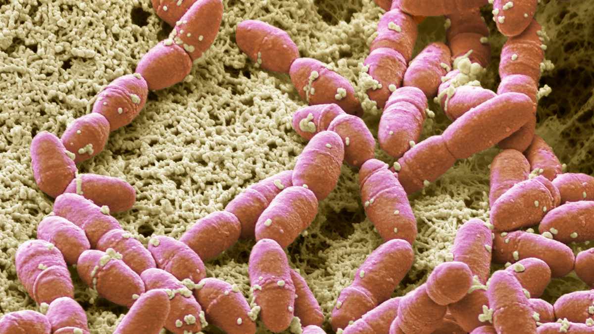 Streptococcus mutant - streptococco