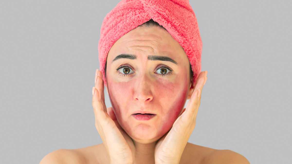 What does MRSA infection look like?