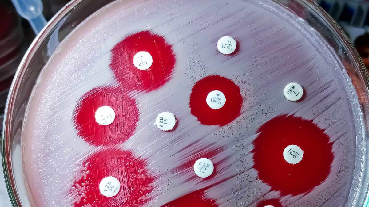 antibiotico. coltura batterica