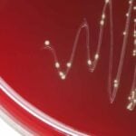 colonia batterica di streptococco in analisi del sangue