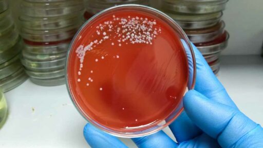 colonia batterica di streptococco in analisi medica