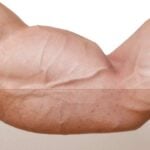esempio di muscolo sviluppato grazie a iniezioni di testosterone