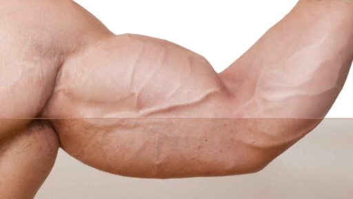 esempio di muscolo sviluppato grazie a iniezioni di testosterone
