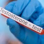 esempio di test del testosterone