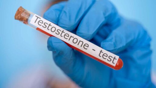 esempio di test del testosterone