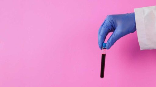 provetta di sangue prelevato per test su provetta sangue per test su trigliceridi