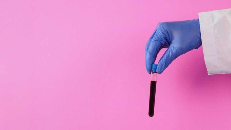 provetta di sangue prelevato per test su provetta sangue per test su trigliceridi
