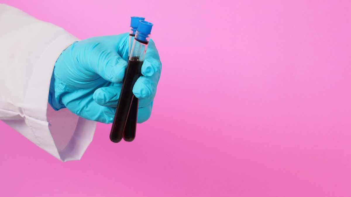 provetta di sangue prelevato utile a test trigliceridi