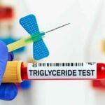 provetta sangue per test trigliceridi